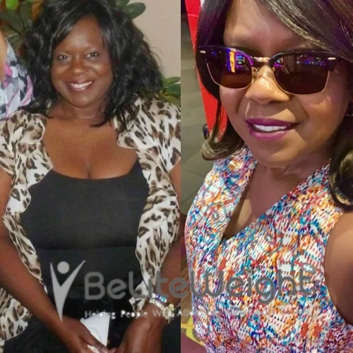 Weight Loss Surgery Before And After Pamela B - 1 Year Update*